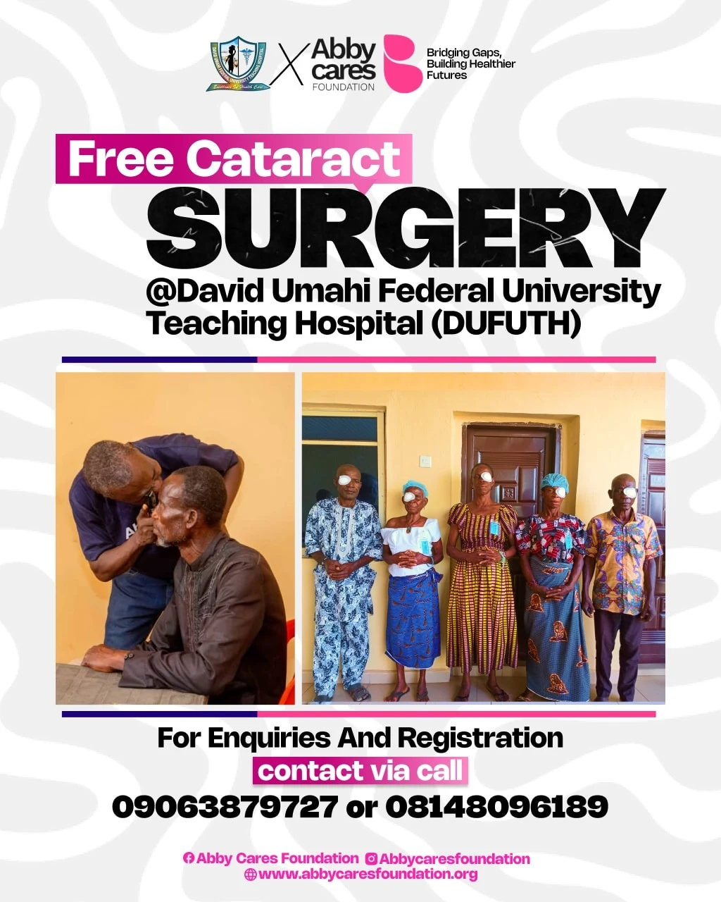 Cataract Surgery – Abby Cares Foundation Cataract Surgery - Abby Cares Foundation
