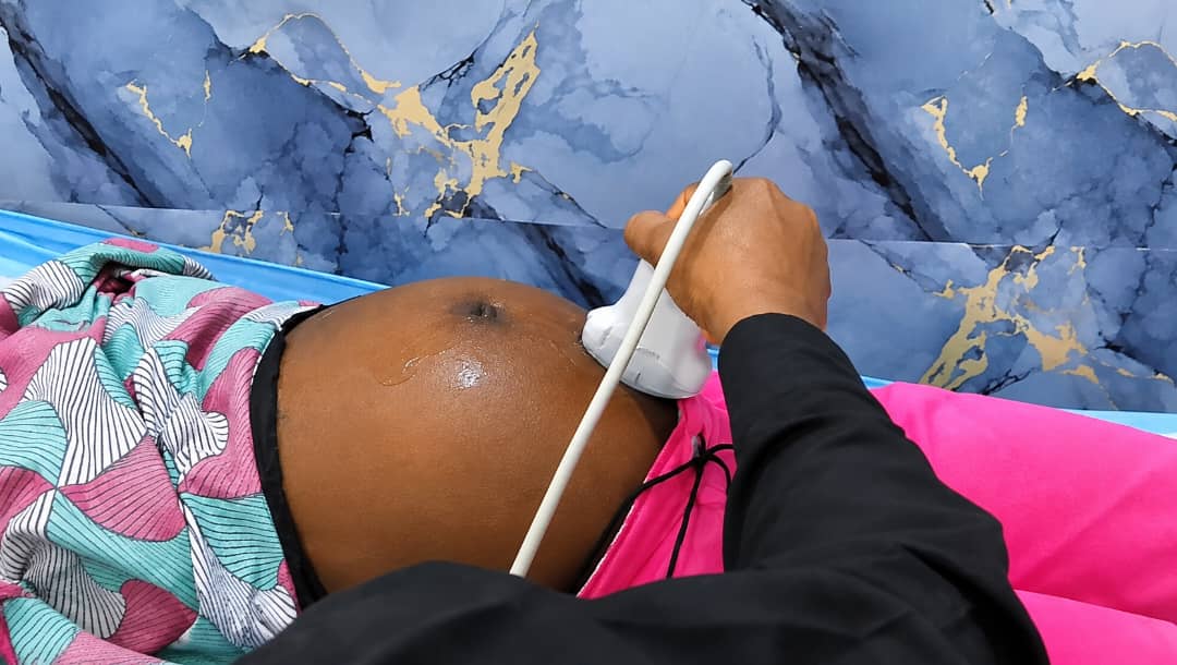 ultra sound womb